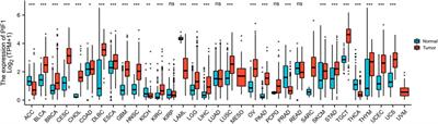 Up-regulated PIF1 predicts poor clinical outcomes and correlates with low immune infiltrates in clear cell renal cell carcinoma